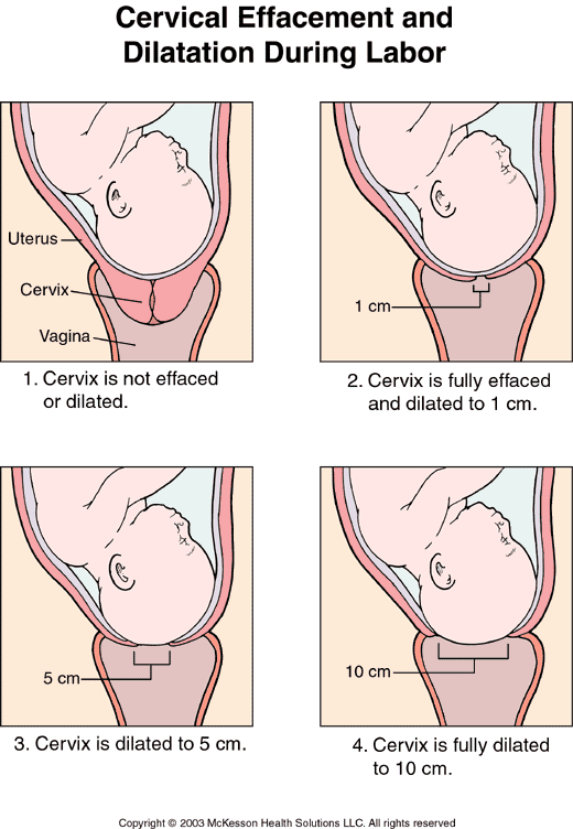 10+centimeters+dilated