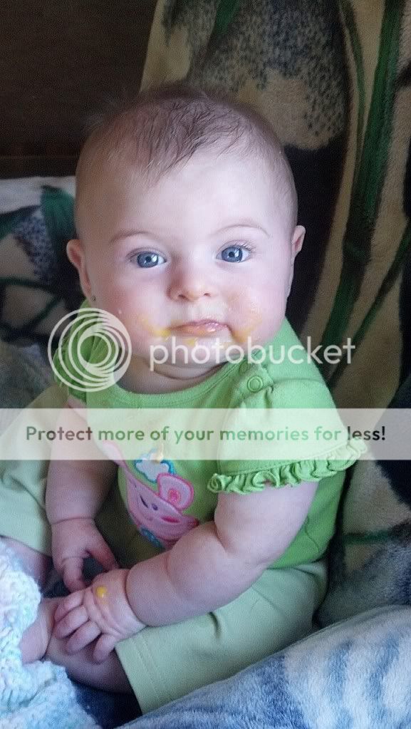 lazy-eye-pics-babycenter